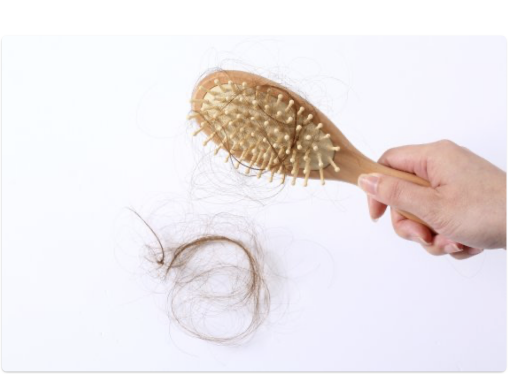 탈모를 예방 및 치료하는 10가지 방법 - 이미지