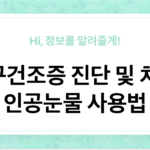 눈이 자주 건조하신가요? 안구건조증 진단 및 치료, 인공눈물 사용법 - 이미지